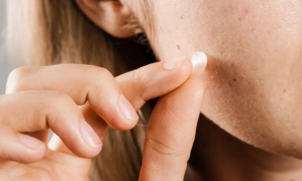 Are You Wasting Your Pimple Patches? 4 Common Mistakes That Ruin Their Effectiveness